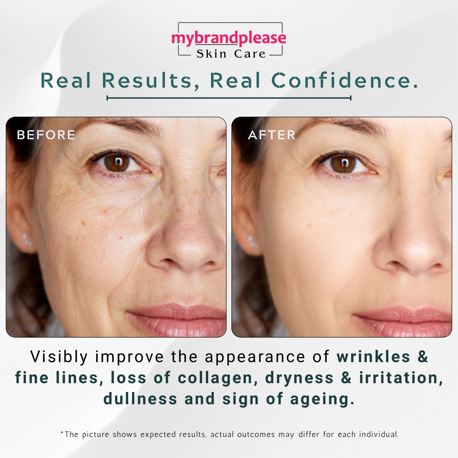 Retinol + Hyaluronic