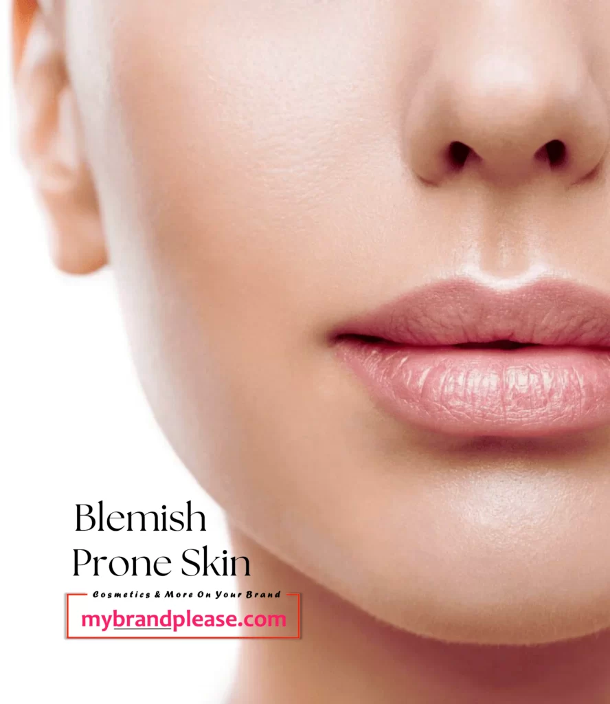 Blemish Prone Skin